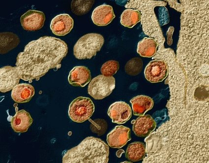 Image: Colored transmission electron micrograph (TEM) of Chlamydia trachomatis bacteria (Photo courtesy of the Eye of Science). Image: Colored transmission electron micrograph (TEM) of Chlamydia trachomatis bacteria (Photo courtesy of the Eye of Science).